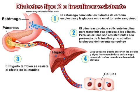 diabetes tipo ii y resistencia a la insulina diabetes tipo ii y resistencia a la insulina