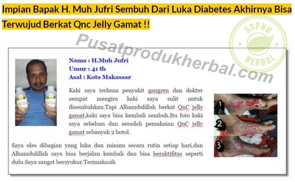 Obat Bintik Berair Pada Kulit Terampuh Obat Bintik Berair Pada Kulit Terampuh
