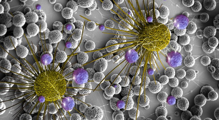 دراسة تفيد أن بعض المضادات الحيوية لديها القدرة على قتل الخلايا السرطانية