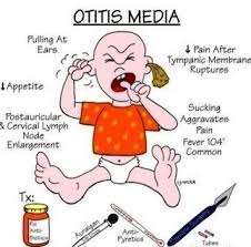 Definisi Etiologi Dan Gejala Klinis Otitis Media Akut Oma Tren