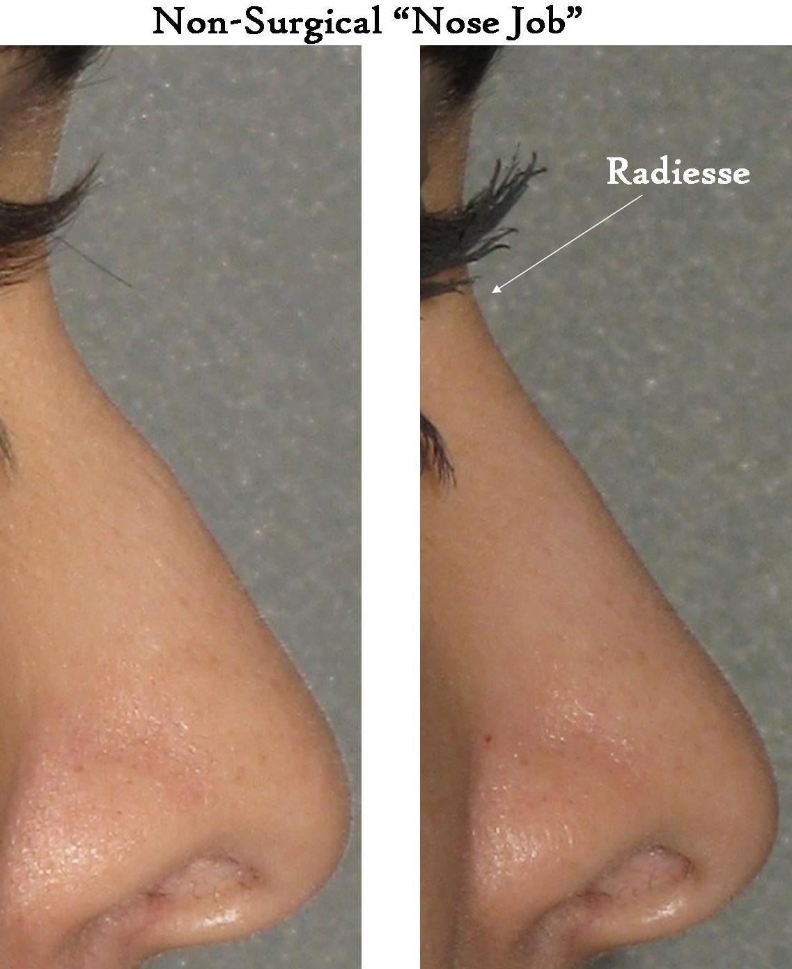 Visible Difference THE NONSURGICAL Visible Difference THE NONSURGICAL