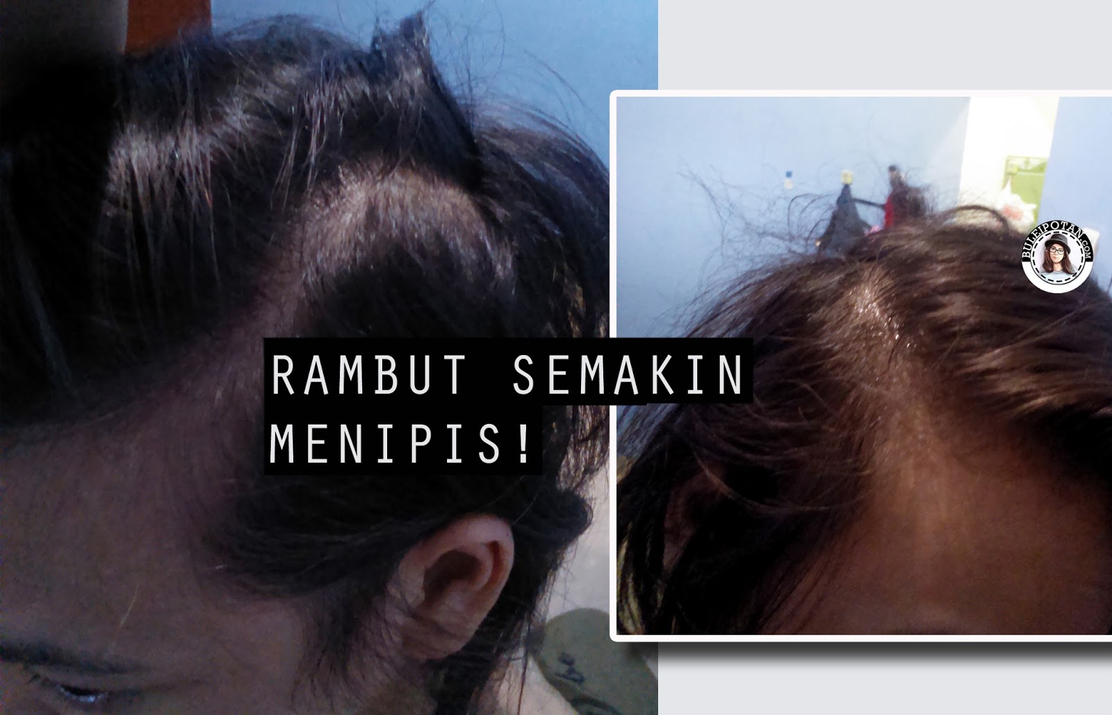 Product Review Ini Perawatan Profesional Untuk Rambut RONTOK Product Review Ini Perawatan Profesional Untuk Rambut RONTOK