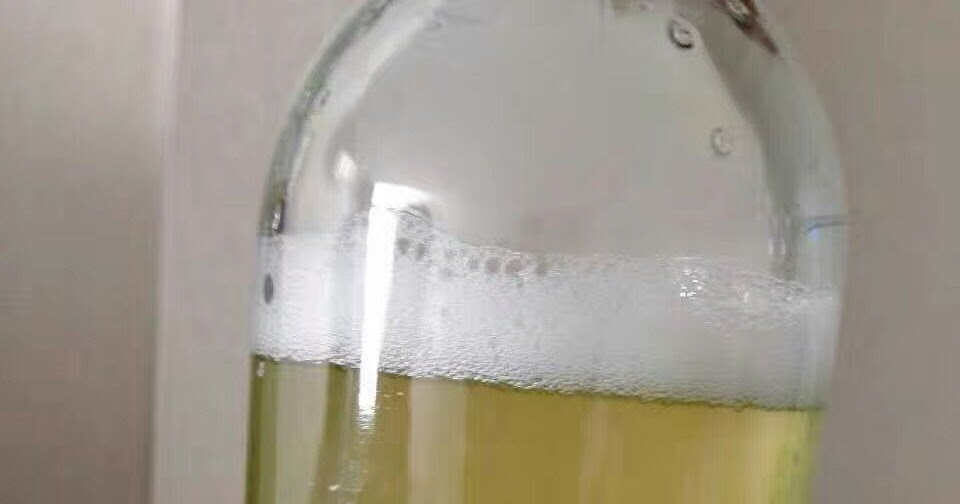 o tratamento da doença renal: Como posso reduzir a proteína em urina