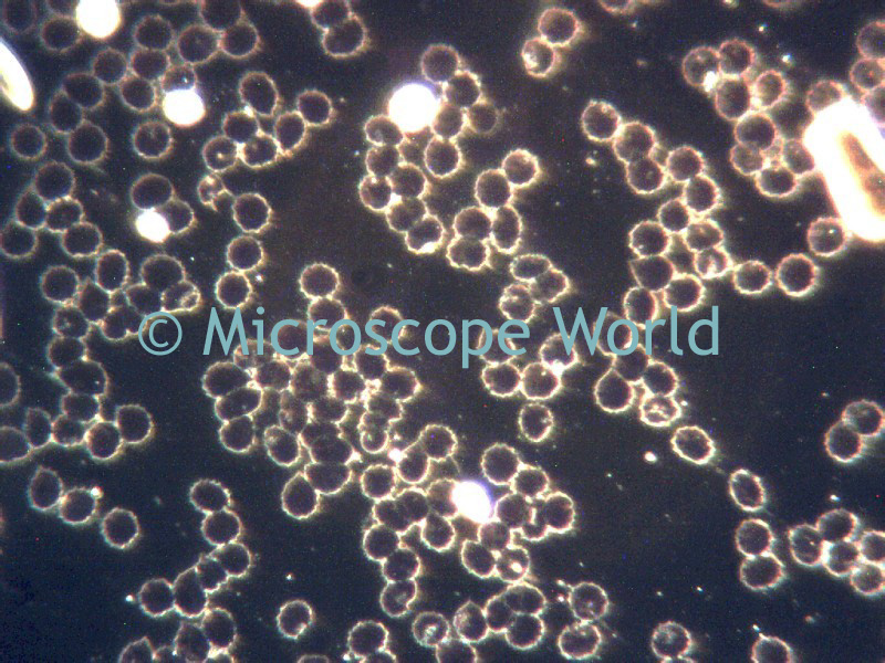 Microscope World Blog Live Blood under Darkfield Microscope