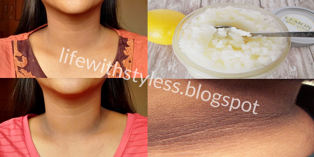 Best Way To Get Rid Of Dark Neck At Home In Just 20 Minutes Life