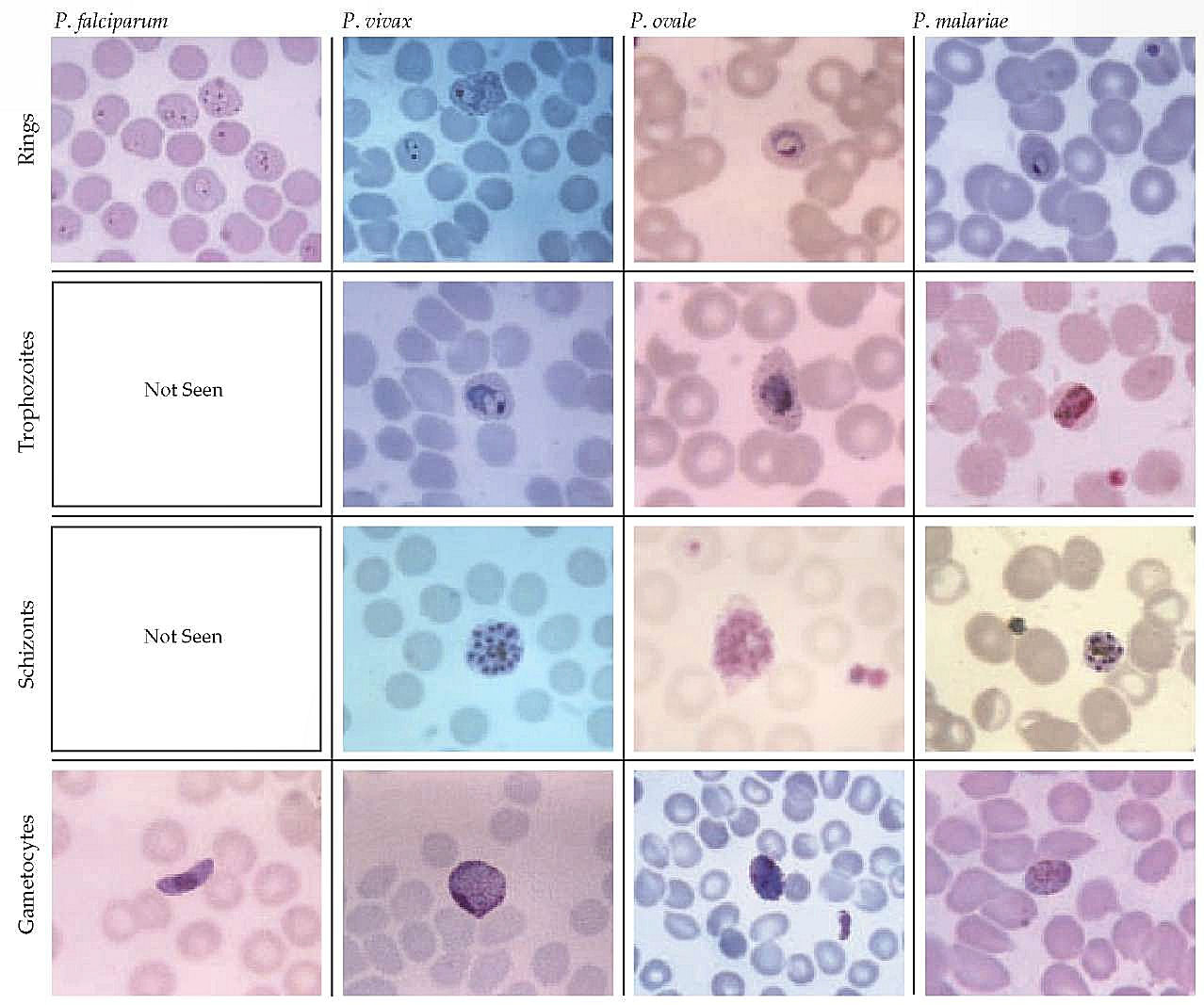 Medical Laboratory and Biomedical Science: Laboratory Identification of Malaria Parasites1278 x 1067