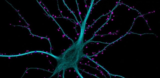 Pesquisadores suecos sintetizam neurônios em laboratório
