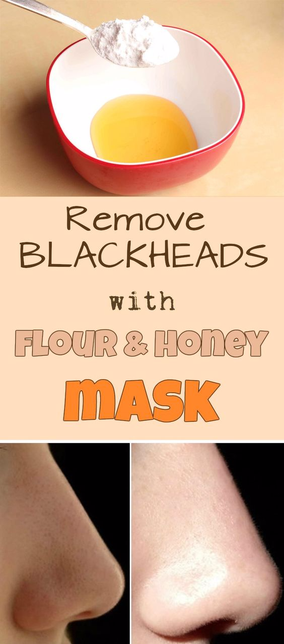 Remove Blackheads With Flour and Honey Mask FITNESS SHORTCUT
