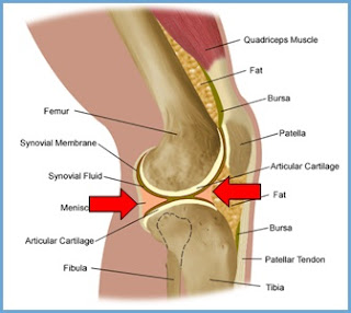 Cedera lutut / meniskus