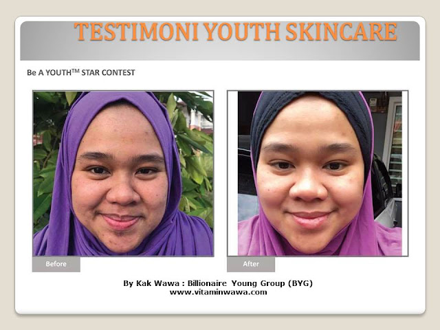 34 Testimoni Youth Skincare Shaklee Terbaru, Youth skincare shaklee, testimoni youth skincare shaklee, Youth Skincare Shaklee : Harga dan Review Pengguna Youth Shaklee, testimoni youth skincare shaklee, testimoni youth skincare shaklee 34 Testimoni Youth Skincare Shaklee Terbaru, Youth skincare shaklee, testimoni youth skincare shaklee, Youth Skincare Shaklee : Harga dan Review Pengguna Youth Shaklee, testimoni youth skincare shaklee, testimoni youth skincare shaklee