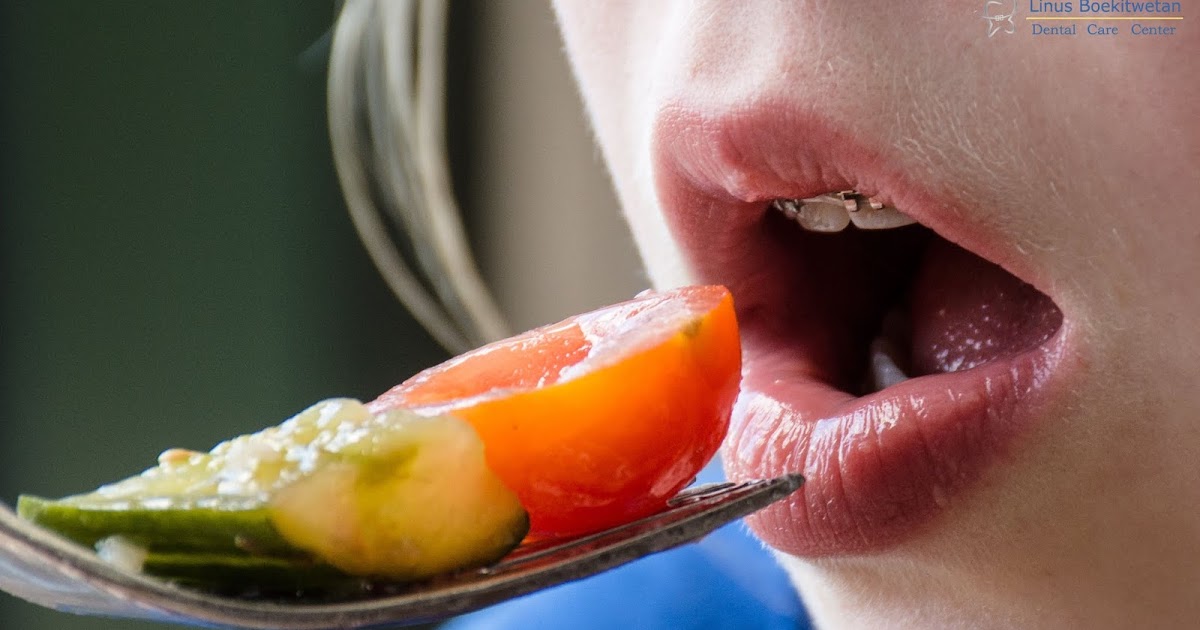 Linus Boekitwetan Dental Care Official Foods While Wearing Braces