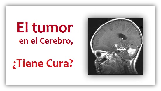 El Tumor en el Cerebro, Tiene Cura? - Un Testimonio de Sanidad con la Ayuda de Dios