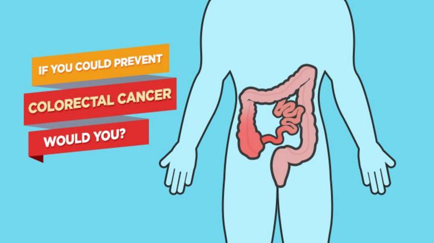 How To Prevent Colon Cancer Naturally