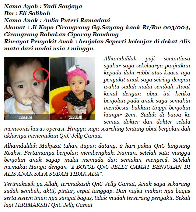 Obat Tradisional Benjolan Di Pinggang Terampuh, Terbukti Sangat Manjur!! Obat Tradisional Benjolan Di Pinggang Terampuh, Terbukti Sangat Manjur!!