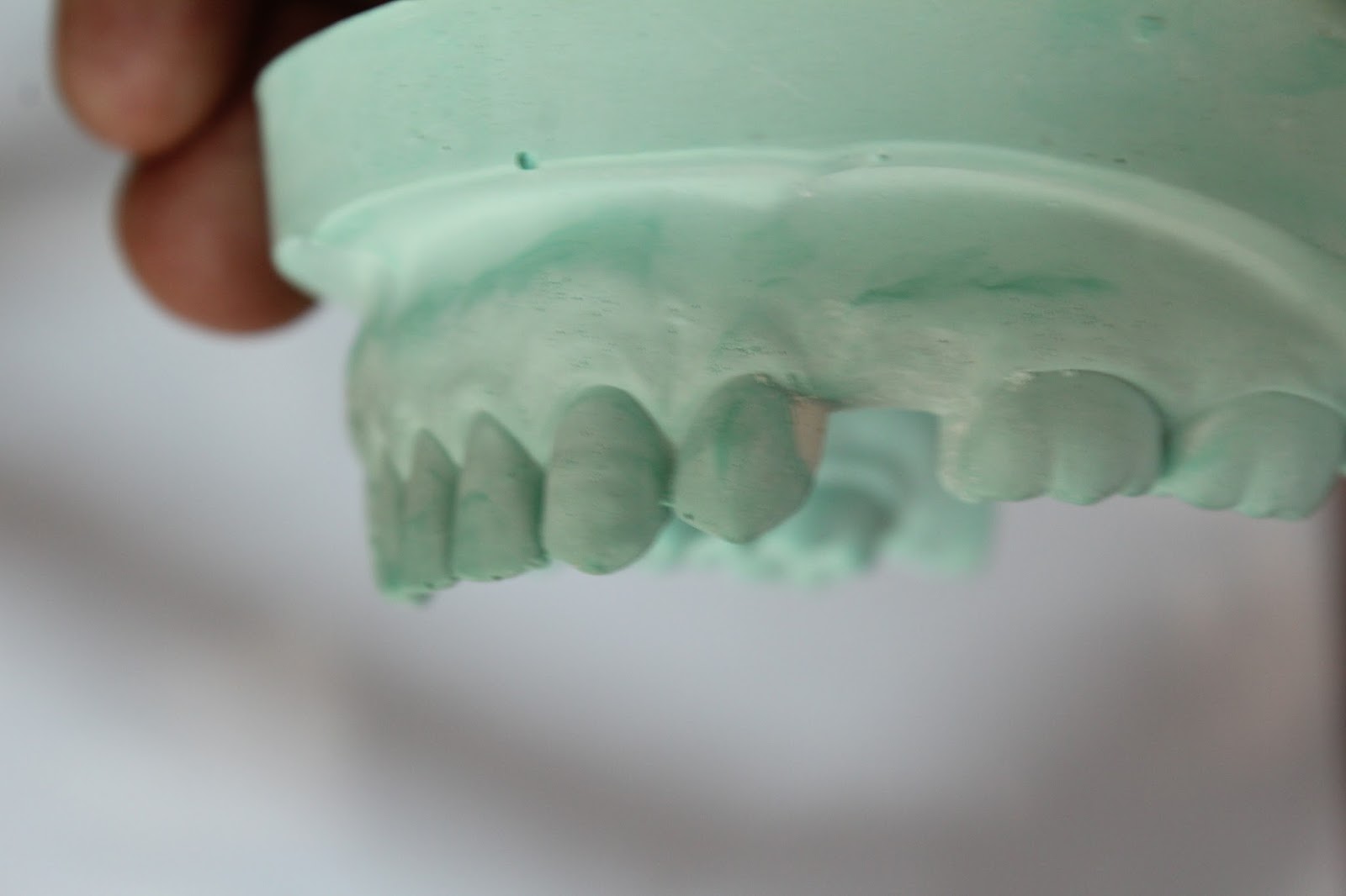 Step by step Guide for Understanding the Prosthodontics Making clasp
