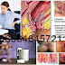 Ciri Wasir Luar (Hemoroid Eksternal) thumbnail