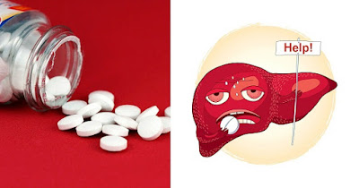 أضرار البراسيتامول 2 Liver damage أضرار البراسيتامول