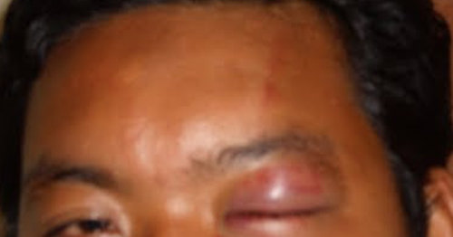 20 Arti Mimpi Di gigit Hewan Menurut Islam dan Primbon Jawa Arti