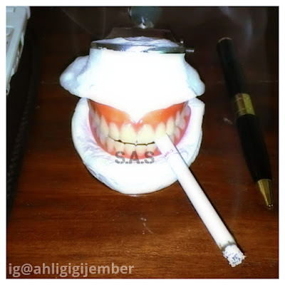 Koleksi foto gigi tiruan akrilik lepasan lepas pasang contoh gigi tiruan