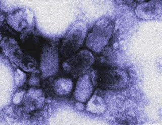 Rabies virus under Transmission Electron Microscope