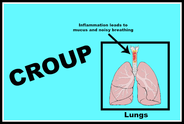 Respiratory Disorders – Croup  Health Secrets and Tips