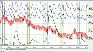 البوليغراف Polygraph