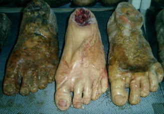 kaki manusia