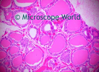 Microscope image of thyroid gland captured at 400x magnification.