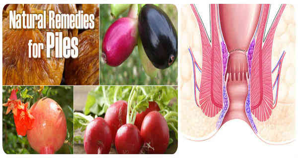 8 Easy Natural Remedies for Piles (Hemorrhoids) Natural Remedies for Piles - Hemorrhoids