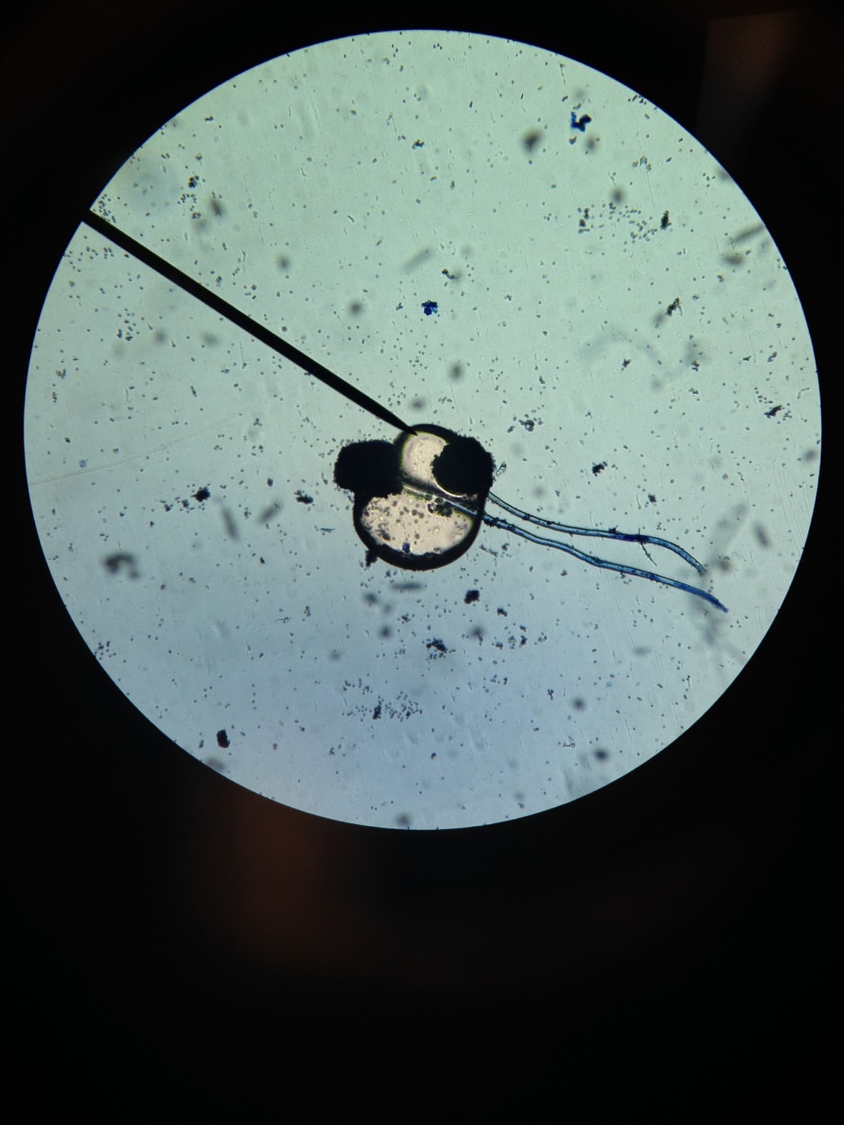 The Cinnamon Note Under The Microscope