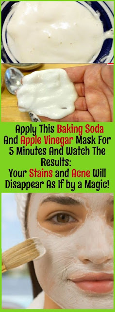 Apply This Baking Soda And Apple Vinegar Mask For 5 Minutes And Watch The Results: Your Stains and Acne Will Disappear As If by a Magic!