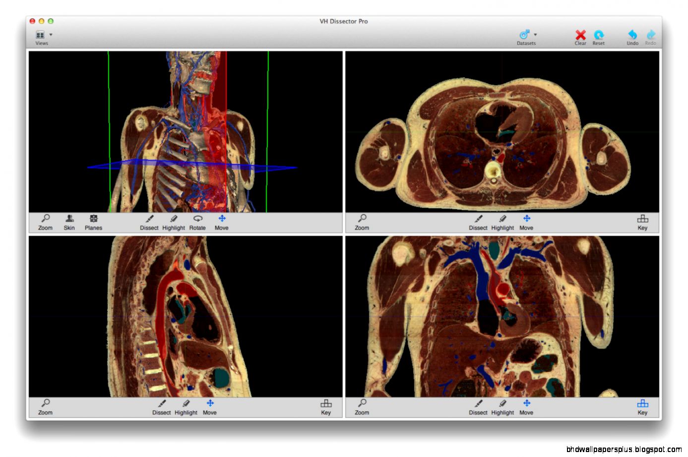 ToLTech   VH Dissector 5