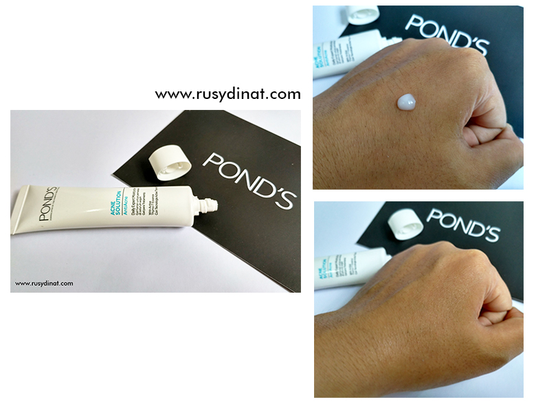 Bundle Of Joy Review POND’S Acne Solution