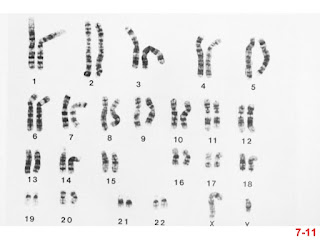 chromosom-ir-gen-mutacijos-11-638.jpg