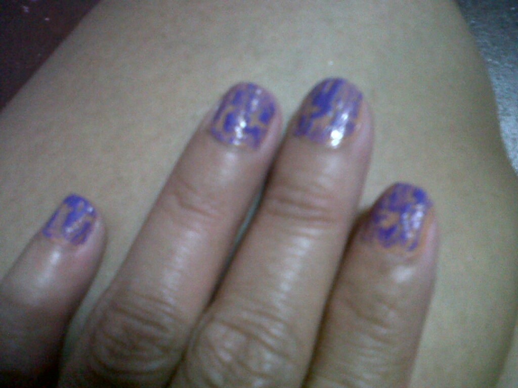 Vertical Cracks In Fingernails