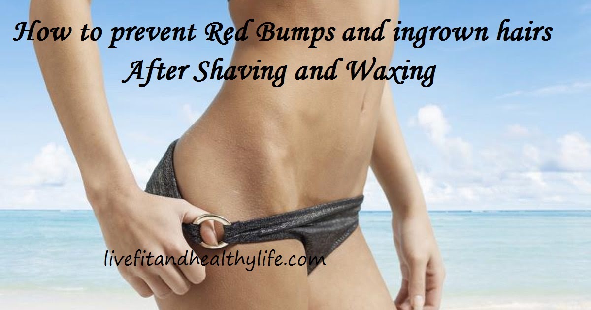 How to prevent Red Bumps and ingrown hairs After Shaving and Waxing