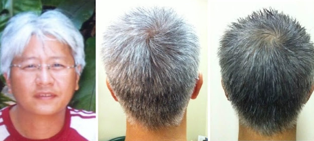 How To Prevent And Eliminate Grey Hair Lens Healthy