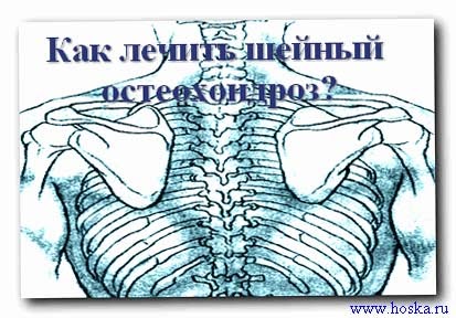 Болит шея и кружится голова чем лечить