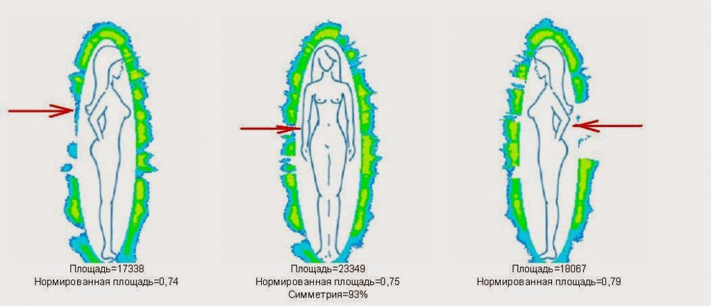 Схема поля человека. Торсионные биополя человека. Морфологическое поле человека это. Морфические поля человека. Торсионные поля человека головы материализация мысли.