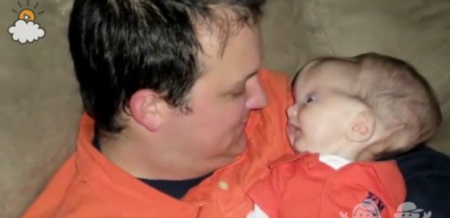 Grab the Tissues. This Miracle Baby?s Story Will Amaze You!