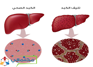 علاقة الوقت بالجسم  %D8%AA%D9%84%D9%8A%D9%81%2B%D8%A7%D9%84%D9%83%D8%A8%D8%AF