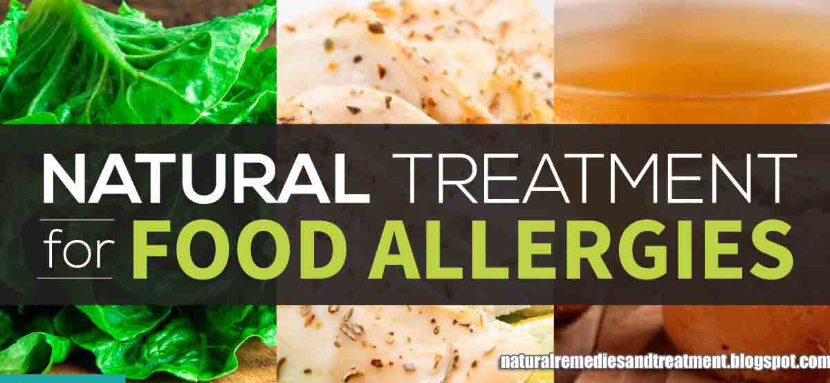 All Symptoms And Home Remedies For Common Food Allergies Natural