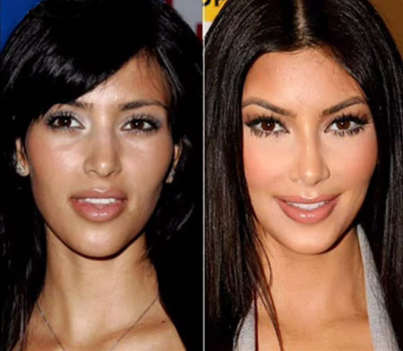 Hey!!! .. Welcome to Kayode Morgan Blogs: Kim Kardashian Before  After Plastic Surgery