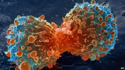 Nghiên cứu mới tìm ra ADN gây ung thư