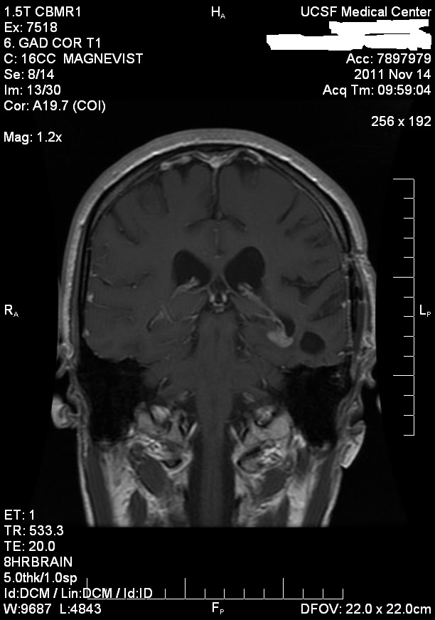 42 Staples November 2011