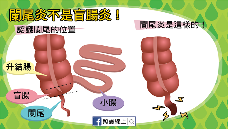 盲腸 位置