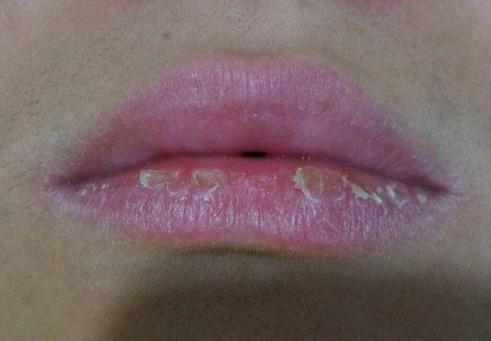 1、口裂（ oralfissure）上下唇之间的横_圈子-新氧美容整形