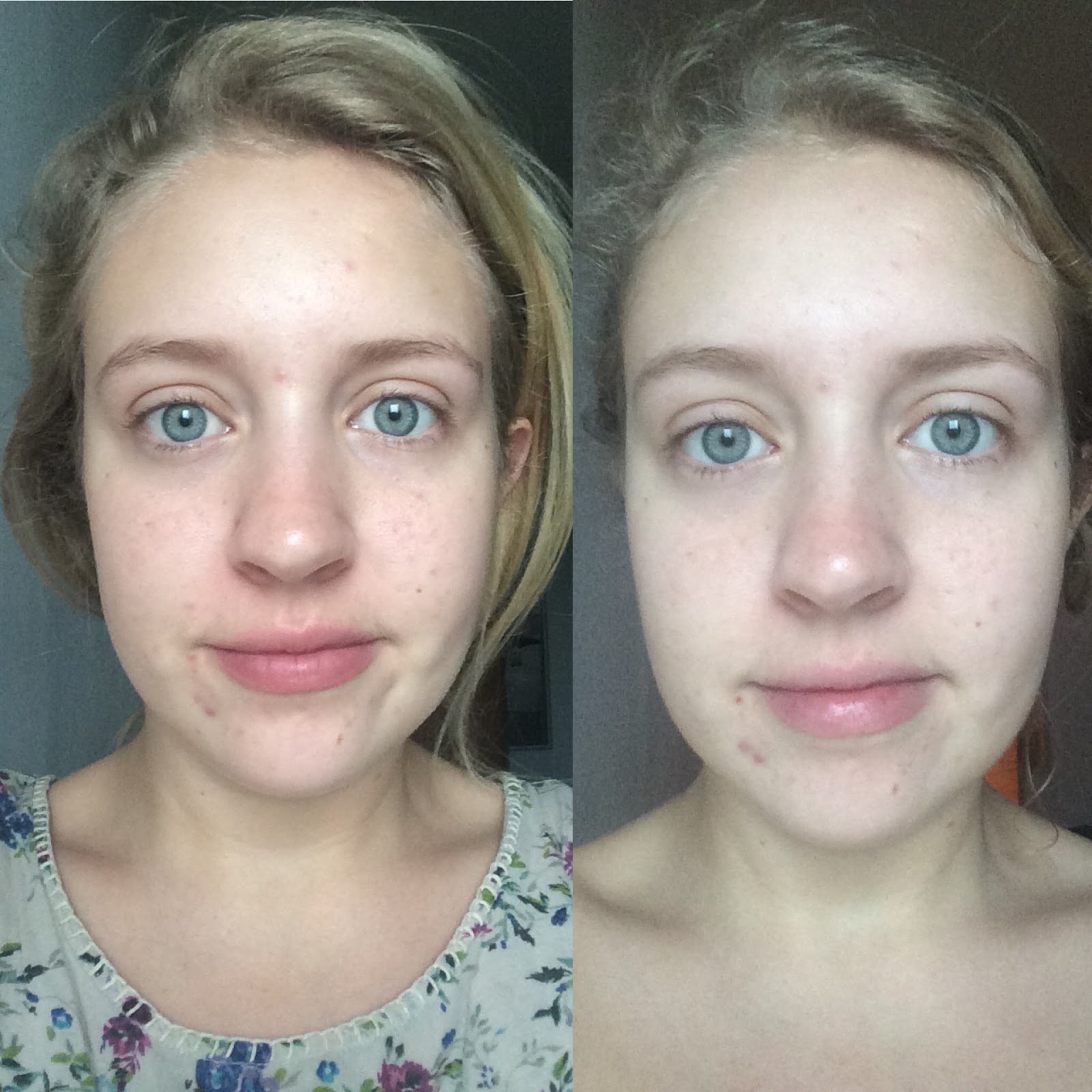 what a looker Skin Laundry Express Laser Facial