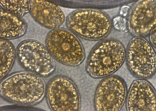 análisis microbiológicos