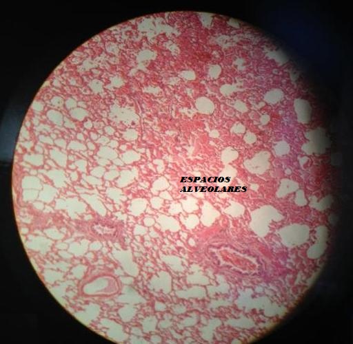 atlas de histología: SISTEMA RESPIRATORIO